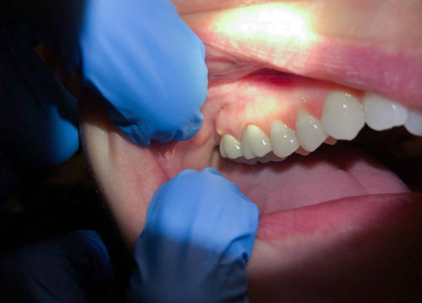 Best Emergency Dental Services for Seniors in Tyler Run, PA