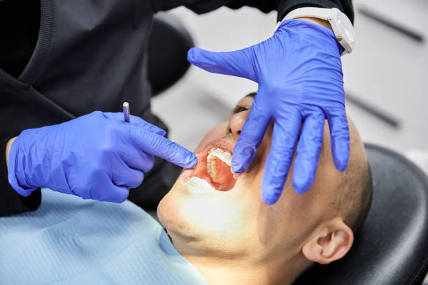 Best Emergency Dentist for Lost Fillings or Crowns in Tyler Run, PA